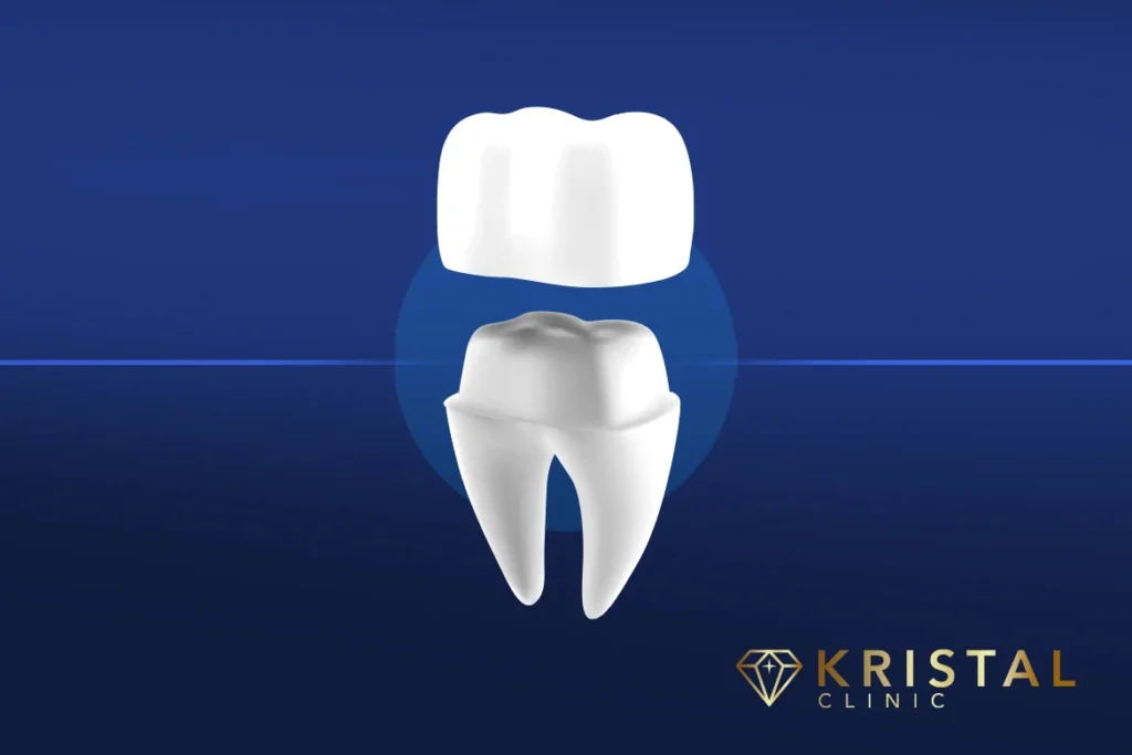 dental-crown