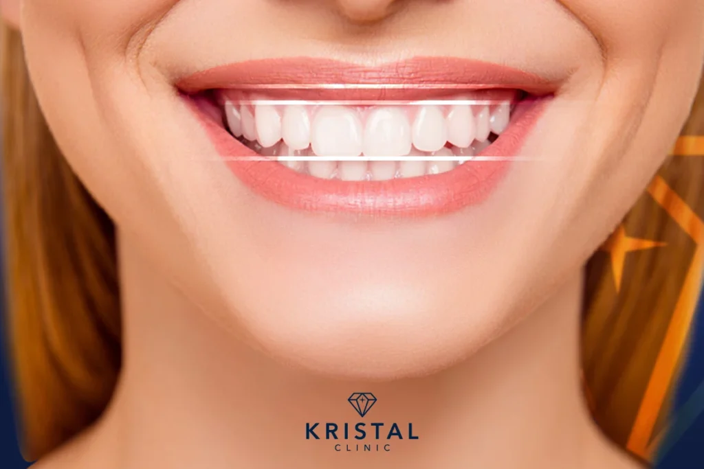 gingival-design.