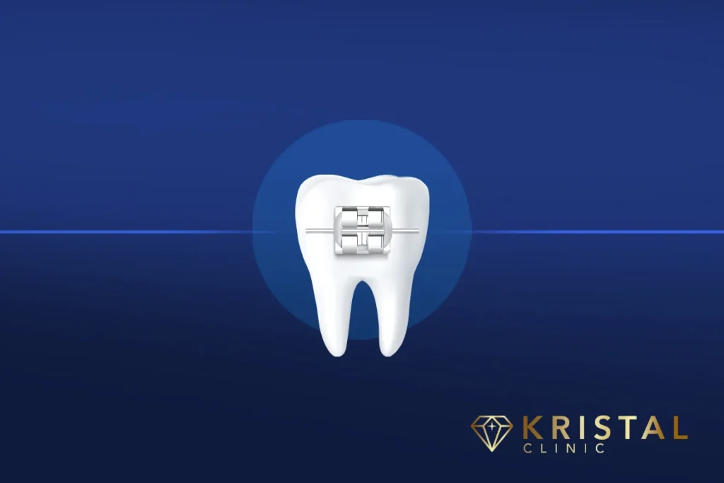 orthodontic